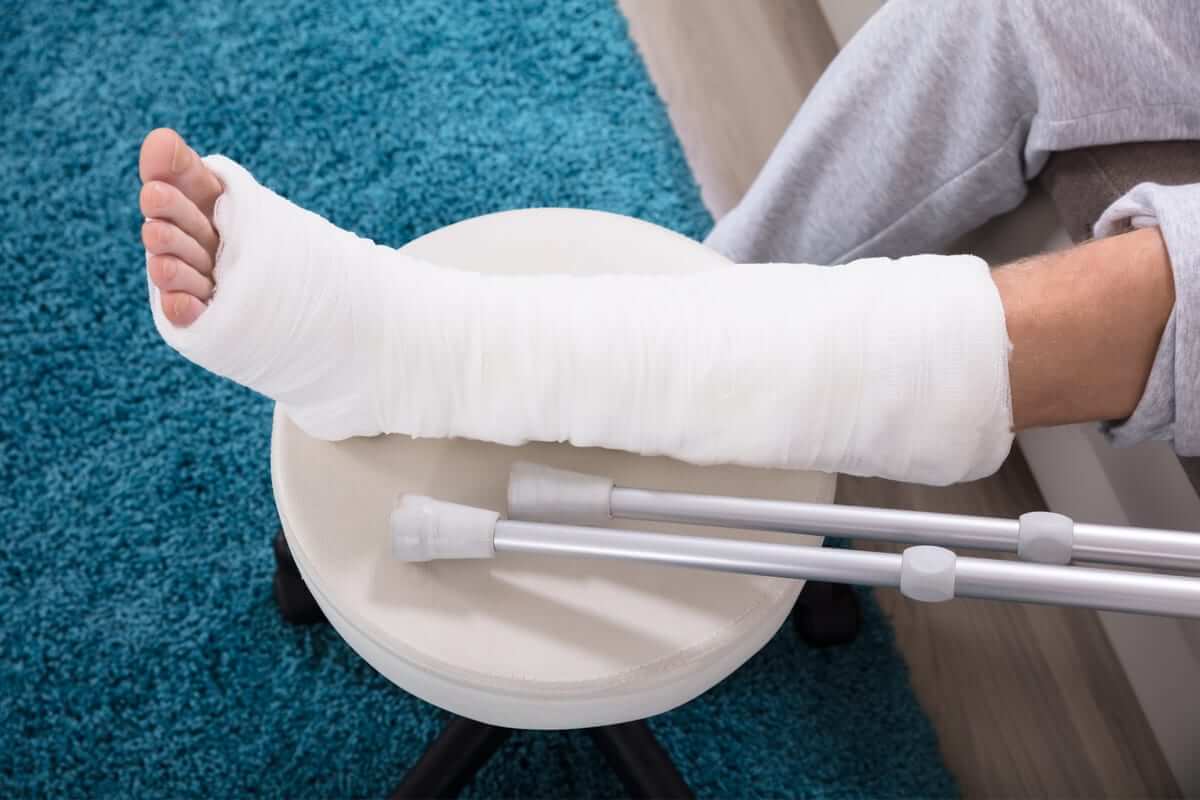 Compensation for Broken and Fractured Bones from an Auto Accident - Corena Law