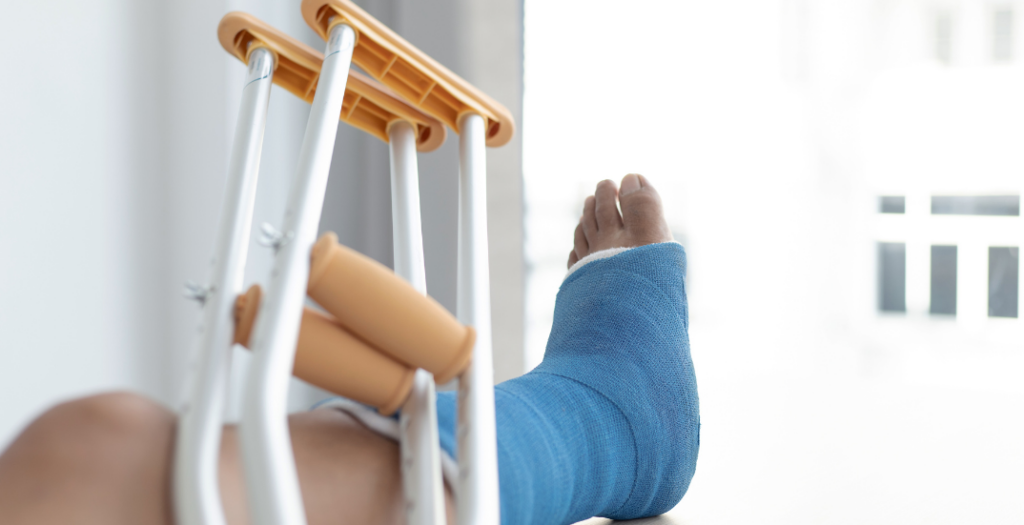 Common Bone Fractures in Car Crashes 