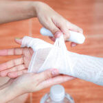 Types of Burn Injury Claims & Liability - corena law