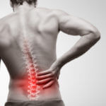 Prove My Back Injury Was Caused by a Car Accident - Corena Law