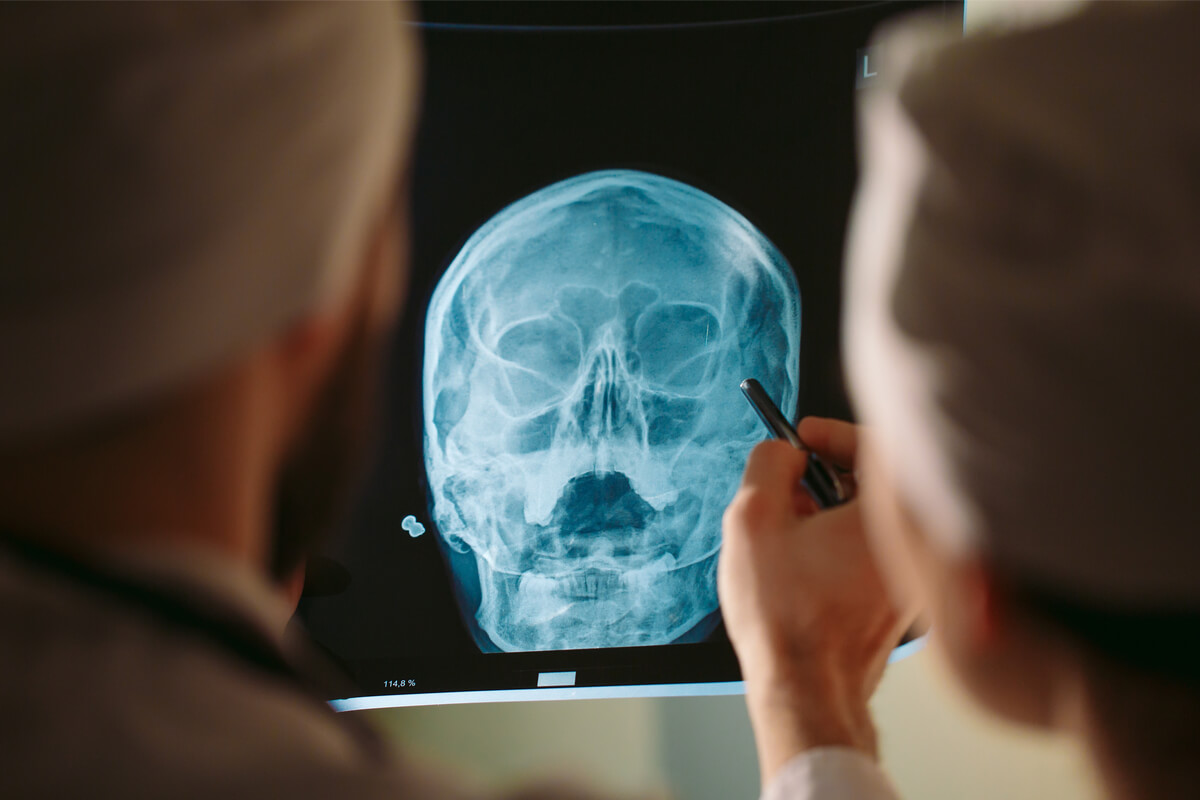 how long does it take to settle a brain injury case - corena law